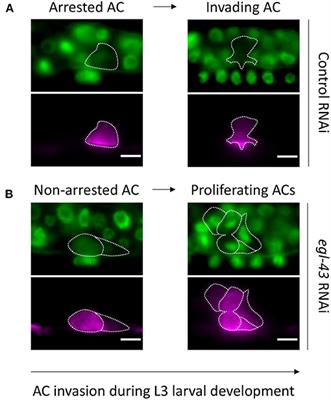 To Divide or Invade: A Look Behind the Scenes of the Proliferation-Invasion Interplay in the Caenorhabditis elegans Anchor Cell